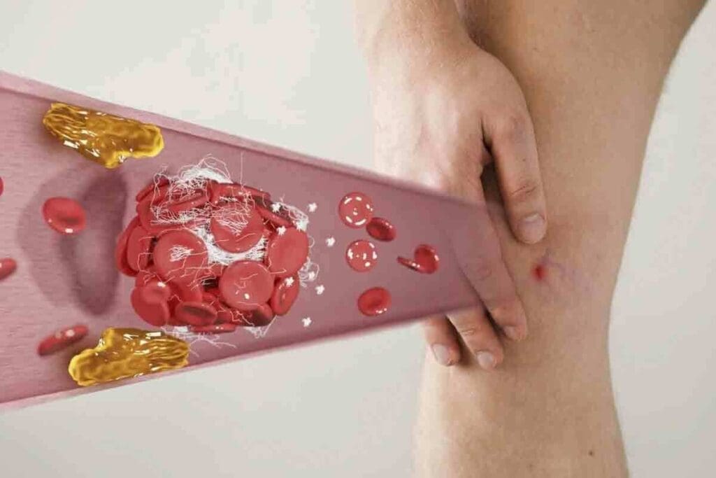 7 Key Blood Clot in Groin Symptoms: Early Signs, Dangers, and When to Seek Help