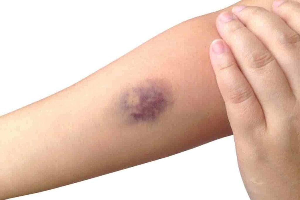 7 Key Blood Clot in Groin Symptoms: Early Signs, Dangers, and When to Seek Help