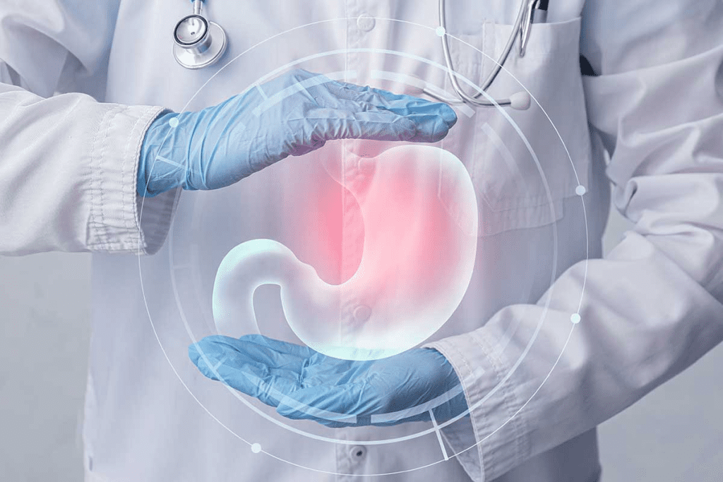 Functional Gastrointestinal Disorder: Most Common Type