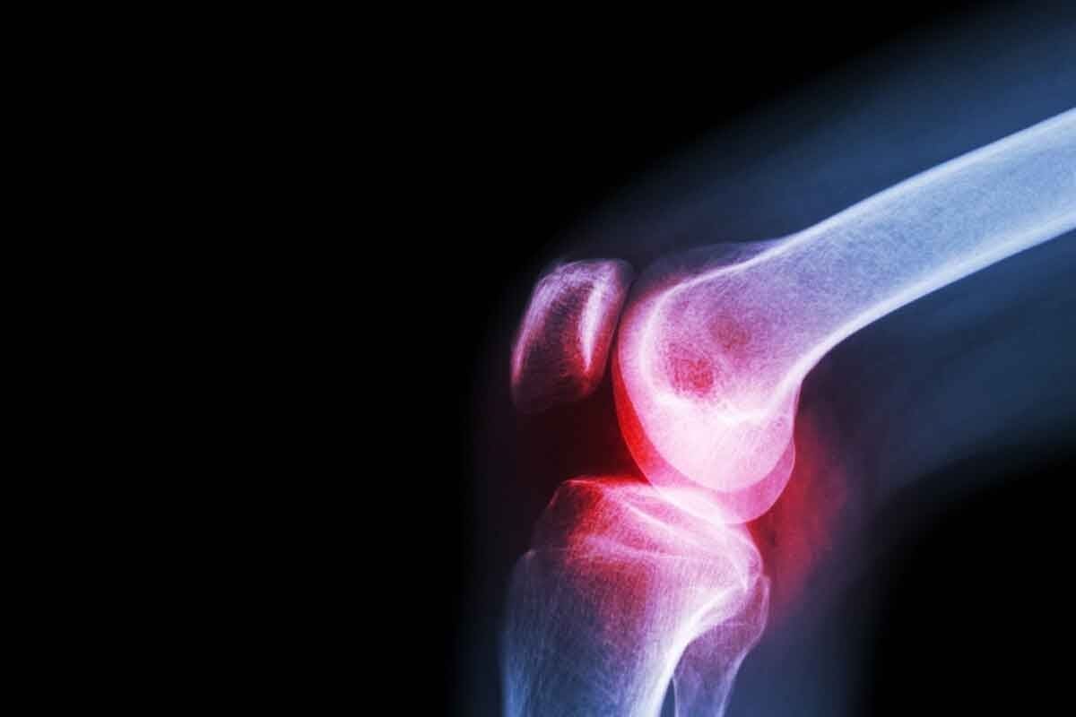 What Is the Treatment for Bone Marrow Cancer and Is It Curable?