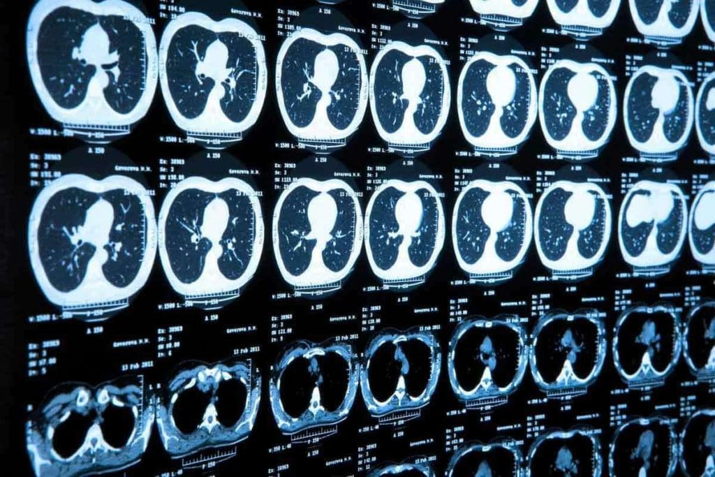 PET CT vs MRI: 8 Key Differences & Benefits 2 PET CT vs MRI: 8 Key Differences & Benefits