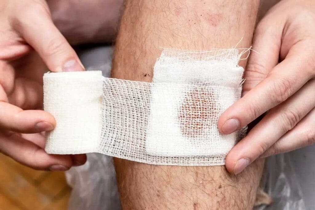 15 Key Symptoms of Blood Clot After Surgery You Shouldn't Ignore