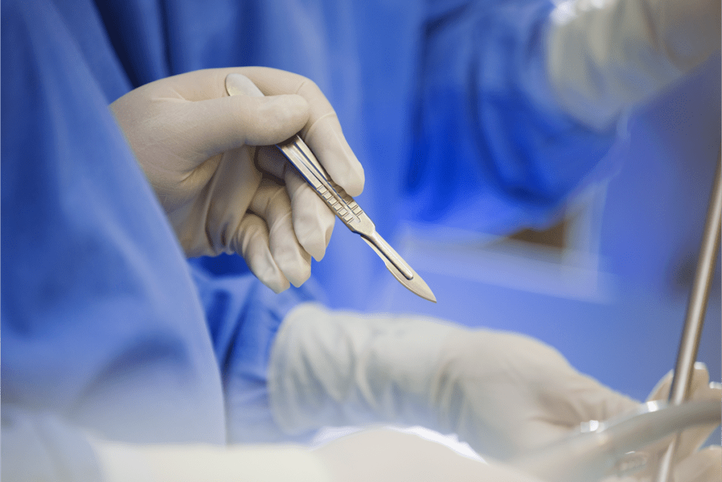 Urethroplasty Time: How Long Does the Procedure Truly Take?