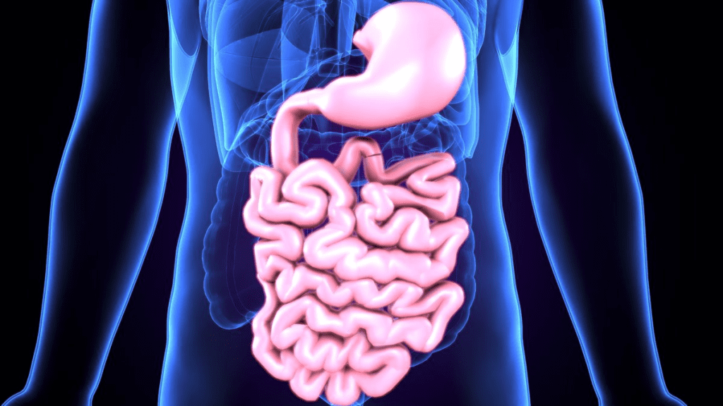 Common GI Malformation: Most Frequent Types 2 Common GI Malformation: Most Frequent Types