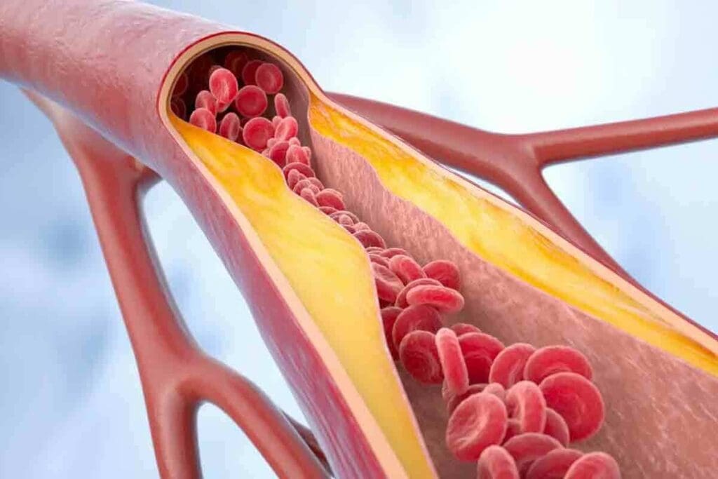 DVT in Arm and Shoulder: Symptoms, Risks, and Treatmen