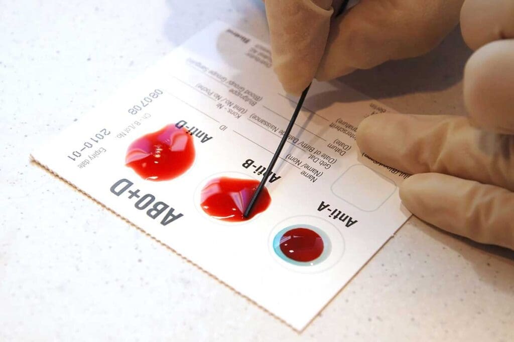 Blood Giving Chart: 8 Essential Blood Type Compatibility Tables 2 Blood Giving Chart: 8 Essential Blood Type Compatibility Tables