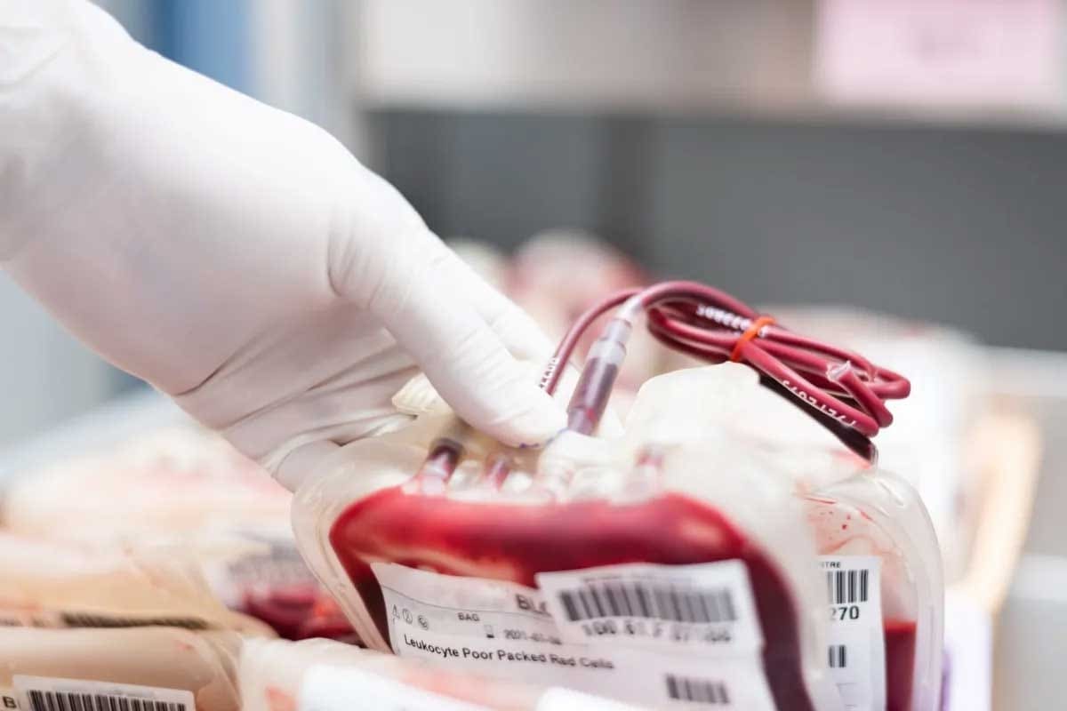 Blood Type A and O Compatibility Explained: 10 Essential Facts and Transfusion Guide type a and type o blood compatibility