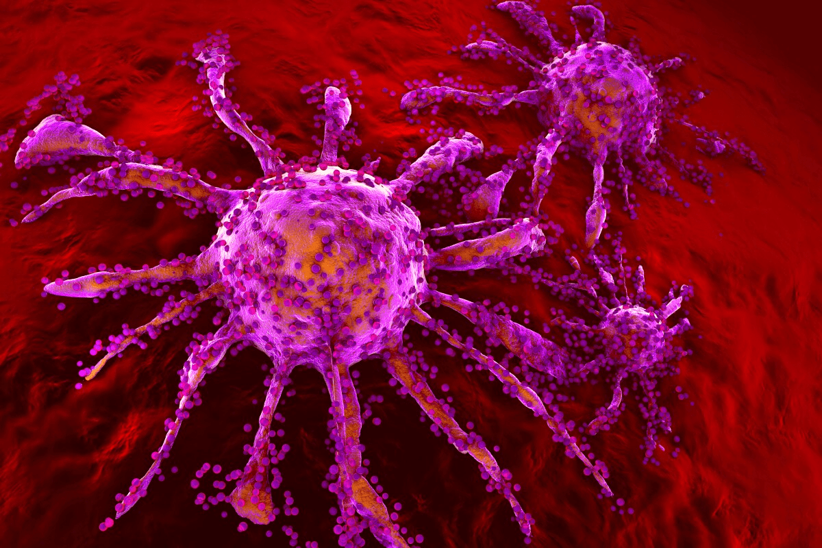 Ovarian cancer first spread: Understanding metastasis.