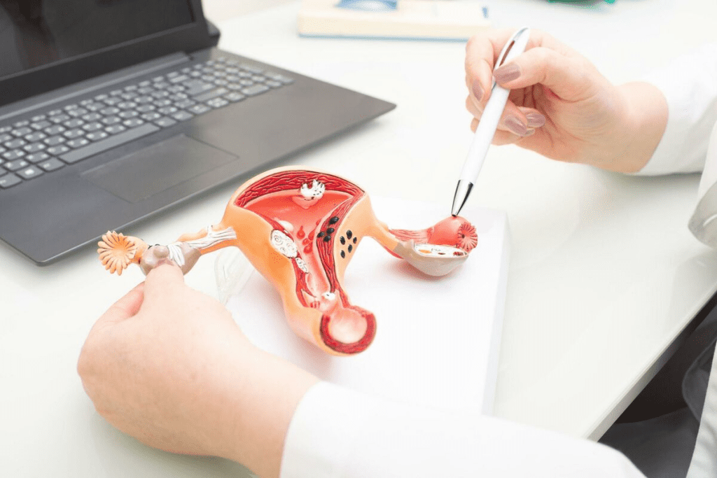 Full Blood Count Ovarian Cancer Detection 1 Full Blood Count Ovarian Cancer Detection