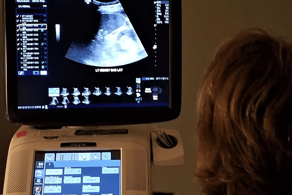 Signs of a bad ultrasound: What they tell you.