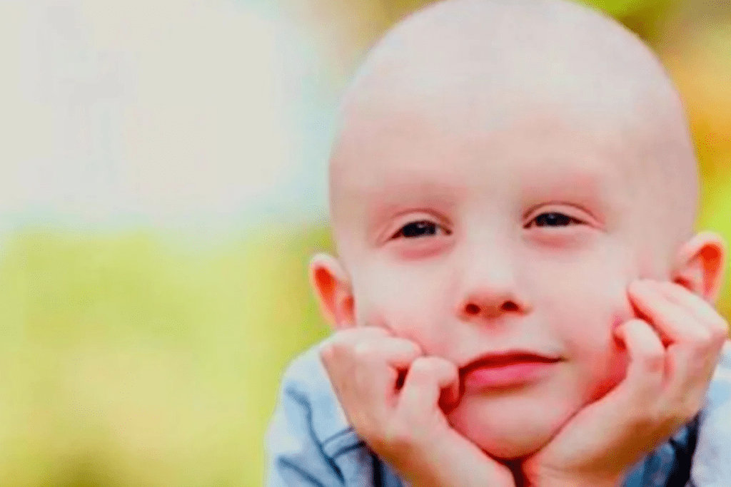 Understanding immunotherapy for leukemia in Pediatric Patients