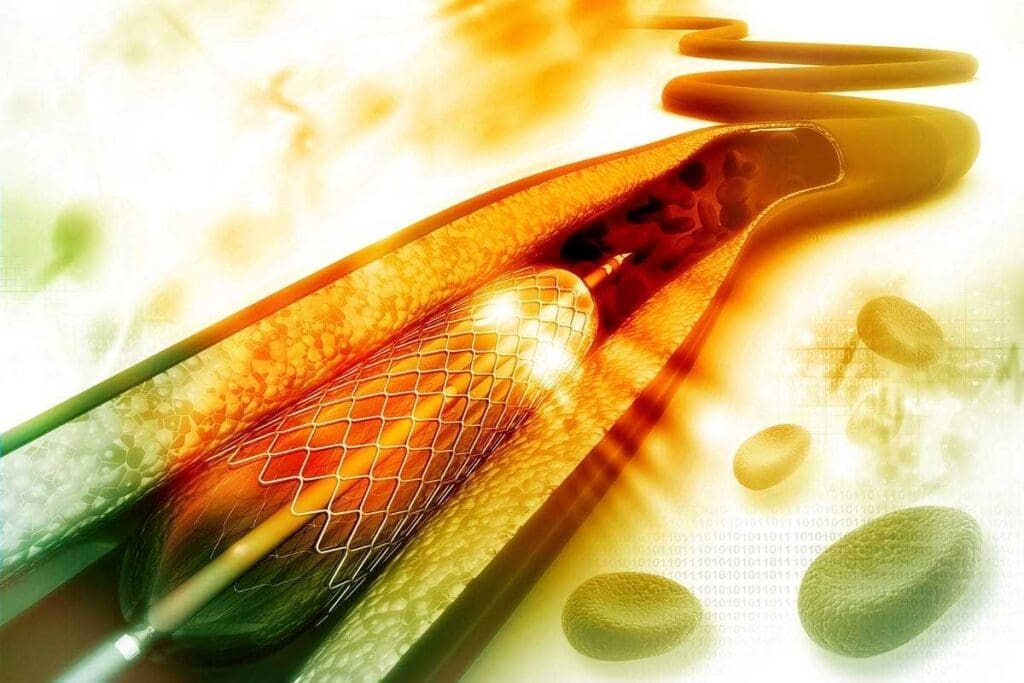 7 Key Facts About Apixaban Use Associated With Cancer: Dosing, Trials, and Best Options