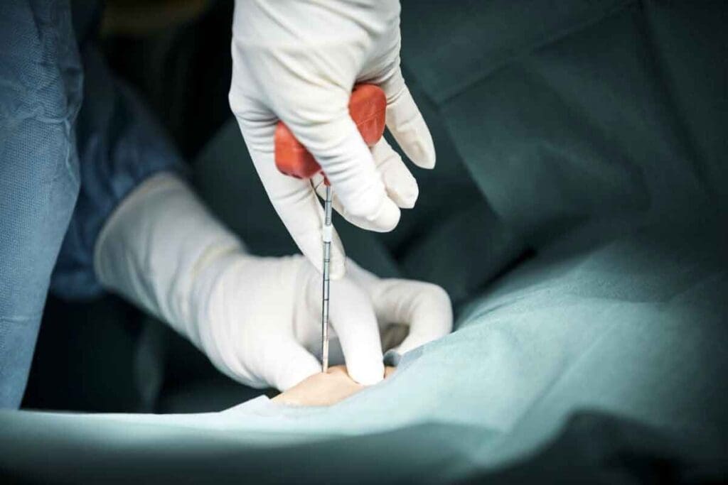 Bone Marrow Transplant Timeline: Key Recovery Stages, Milestones, and Process