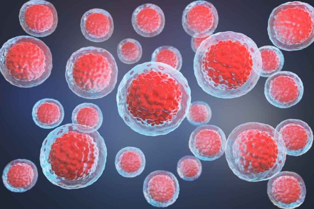 Bone Marrow Transplant Timeline: Key Recovery Stages, Milestones, and Process