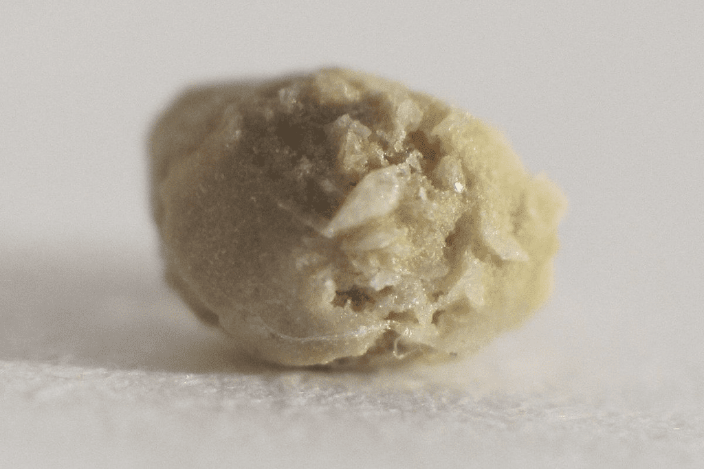 Oxalate: The Ultimate Low-Oxalate Veggie Guide