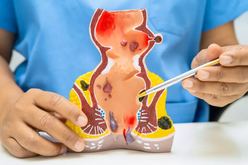 How to Diagnose an Aortic Aneurysm: Step-by-Step Tests and Examination 1 How to Diagnose an Aortic Aneurysm: Step-by-Step Tests and Examination