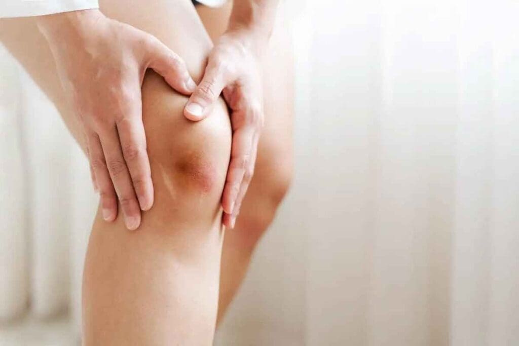 How Can You Tell If a Blood Clot Bruise on Thigh Is Causing That Mark?