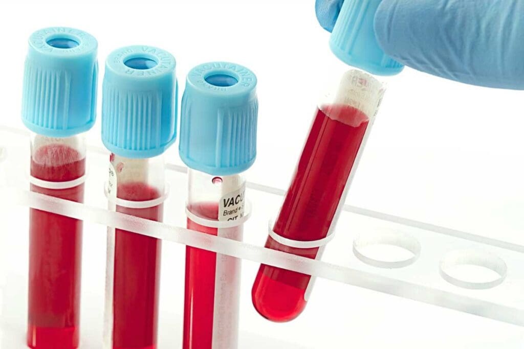 What Can Blood Work Show? 12 Key Things Blood Tests Can Detect Quickly