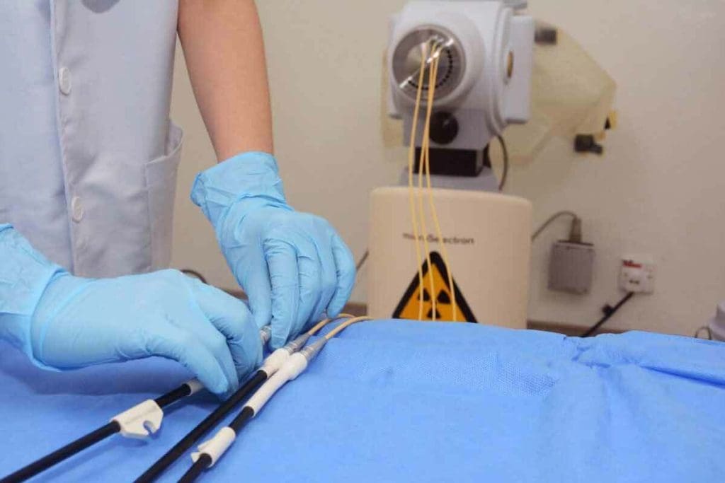 External vs Internal Radiation Therapy: 7 Types