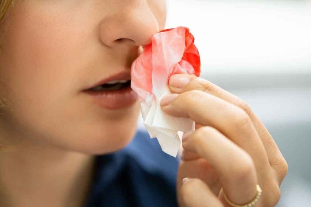 Leukemia Nosebleeds: 10 Crucial Symptoms to Watch