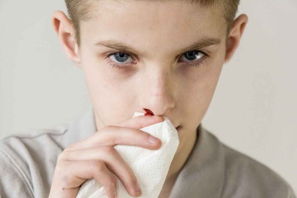Leukemia Nosebleed: 7 Critical Symptoms to Know