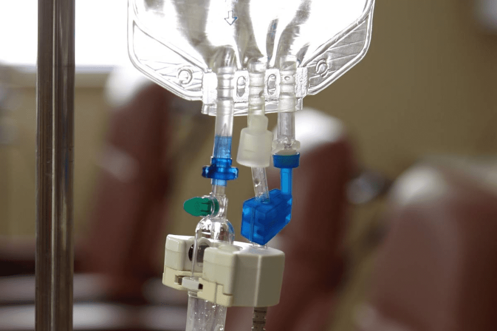 Understanding where chemo port goes in the body