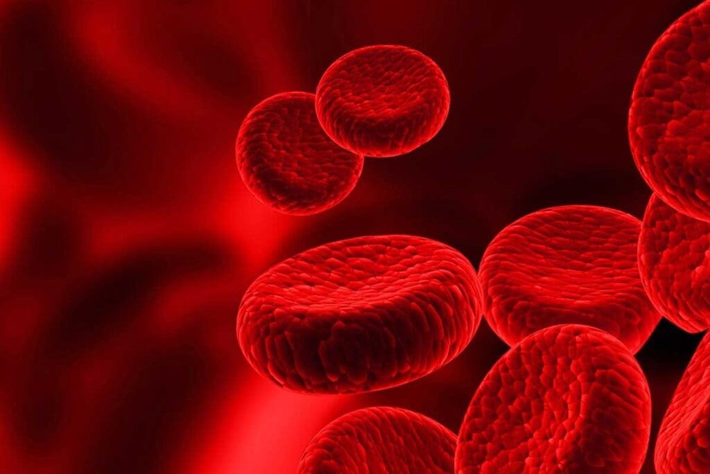 Unexplained Anemia: 8 Crucial Causes in the Elderly