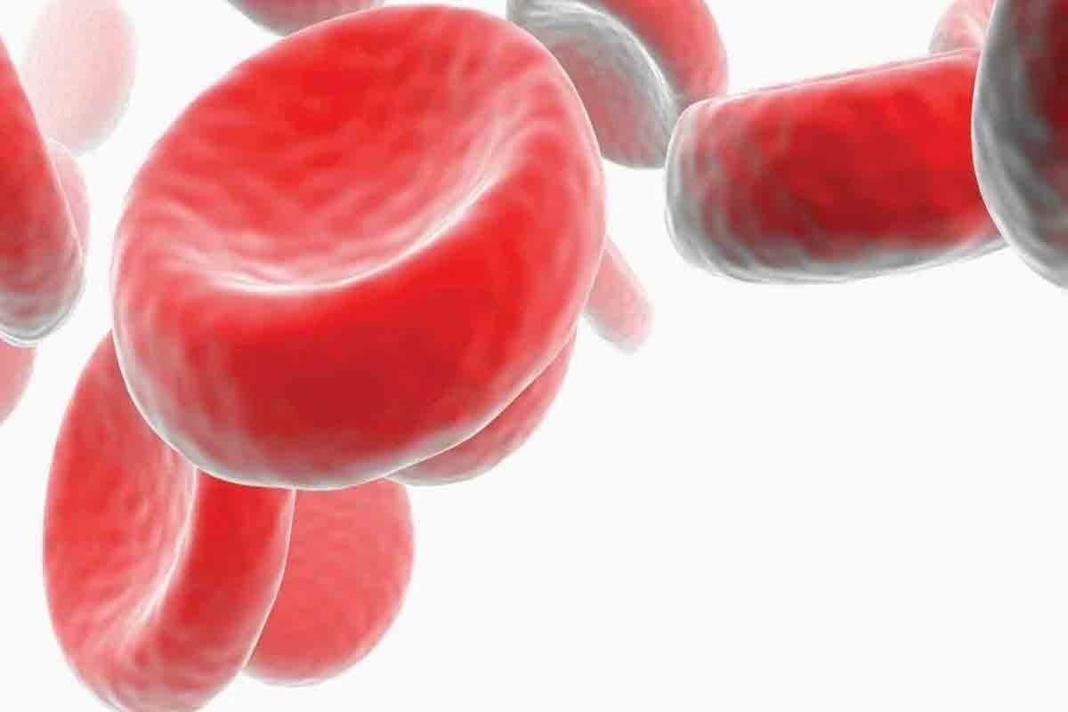 Diagnostic Criteria For Aplastic Anemia: 7 Essential Tests