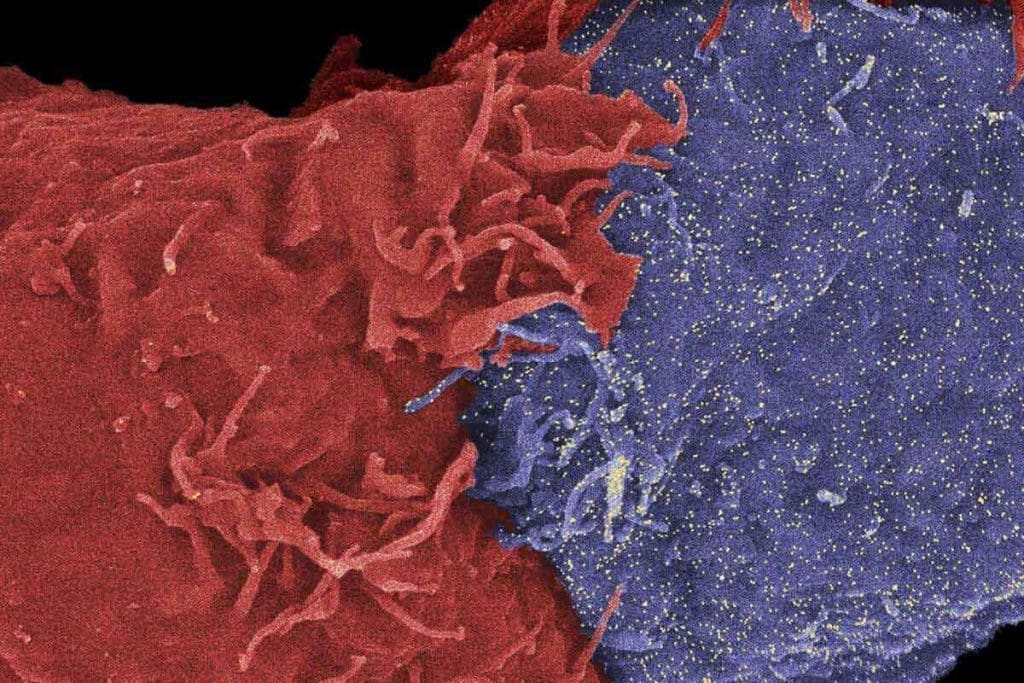 Benefits of Radiation: An Amazing Cancer Fighter