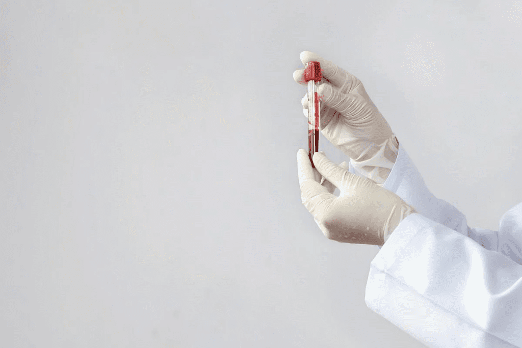 Disease Associated with Plasma Cells: Critical Facts