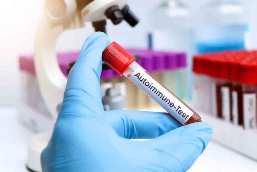 Autoimmune Disease Iron Deficiency: 7 Key Facts