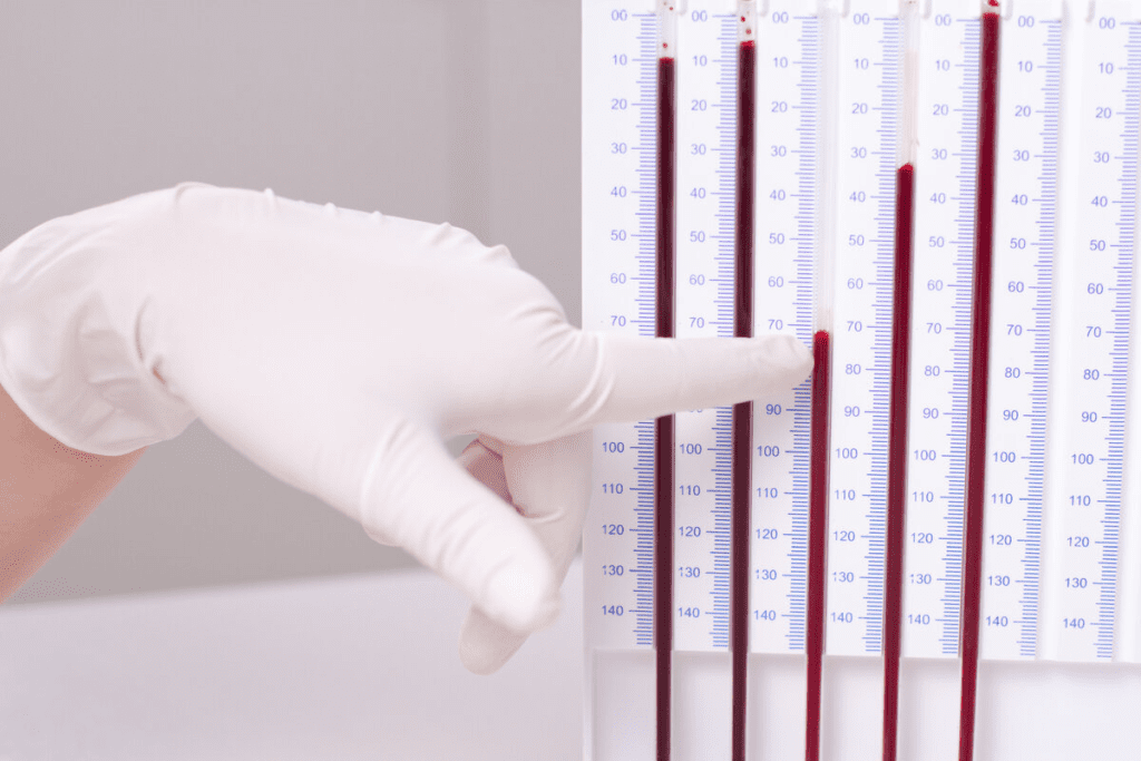 Test for Antibodies: The Ultimate, Simple Guide
