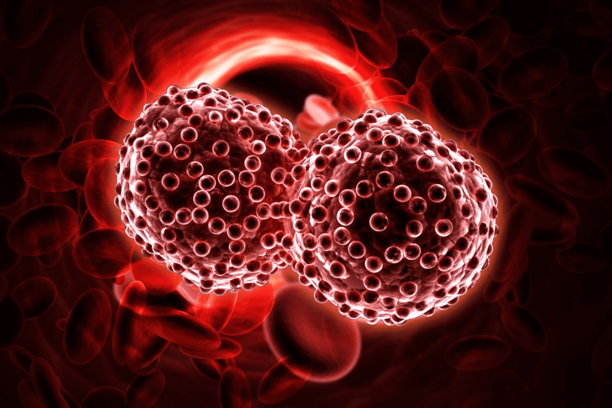 Prostate Cancer Survival Rate: New Facts