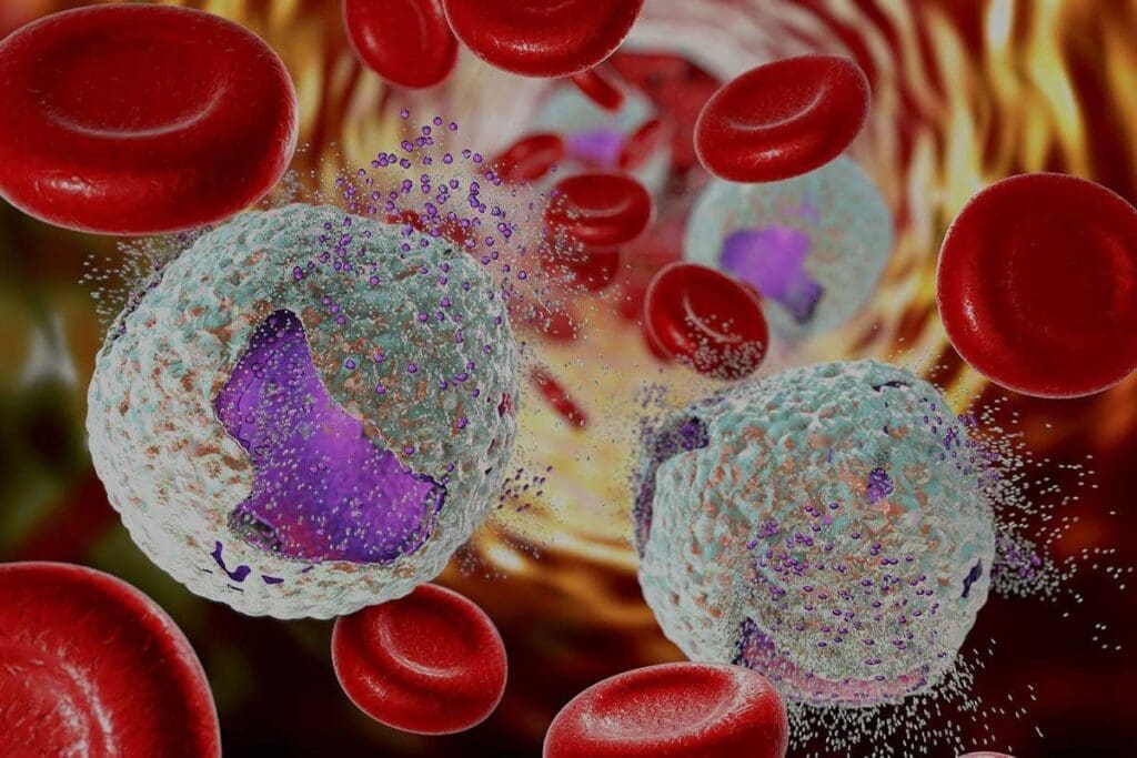 Acute B Leukemia: 10 Key Survival Facts & Rates