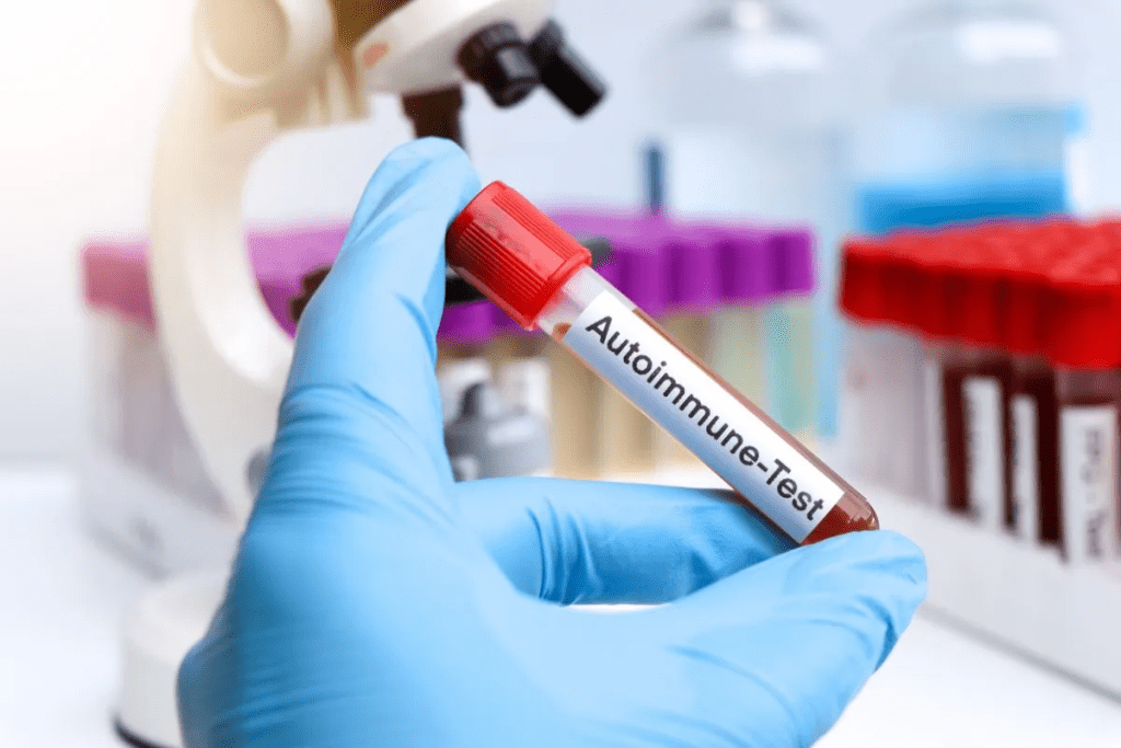 Autoimmune Blood Disorders: Hematologist Role