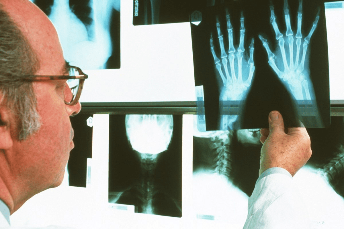 Blood Test for Autoimmune Disease: Signs & Results