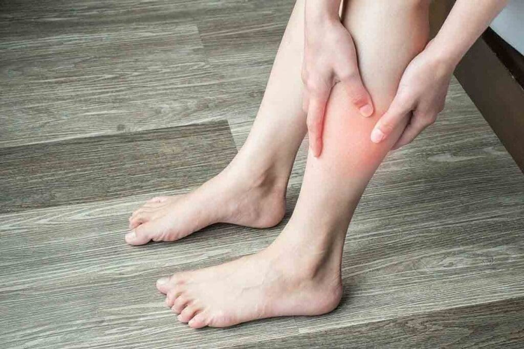 Anemia Swelling: Crucial Facts on Edema Causes