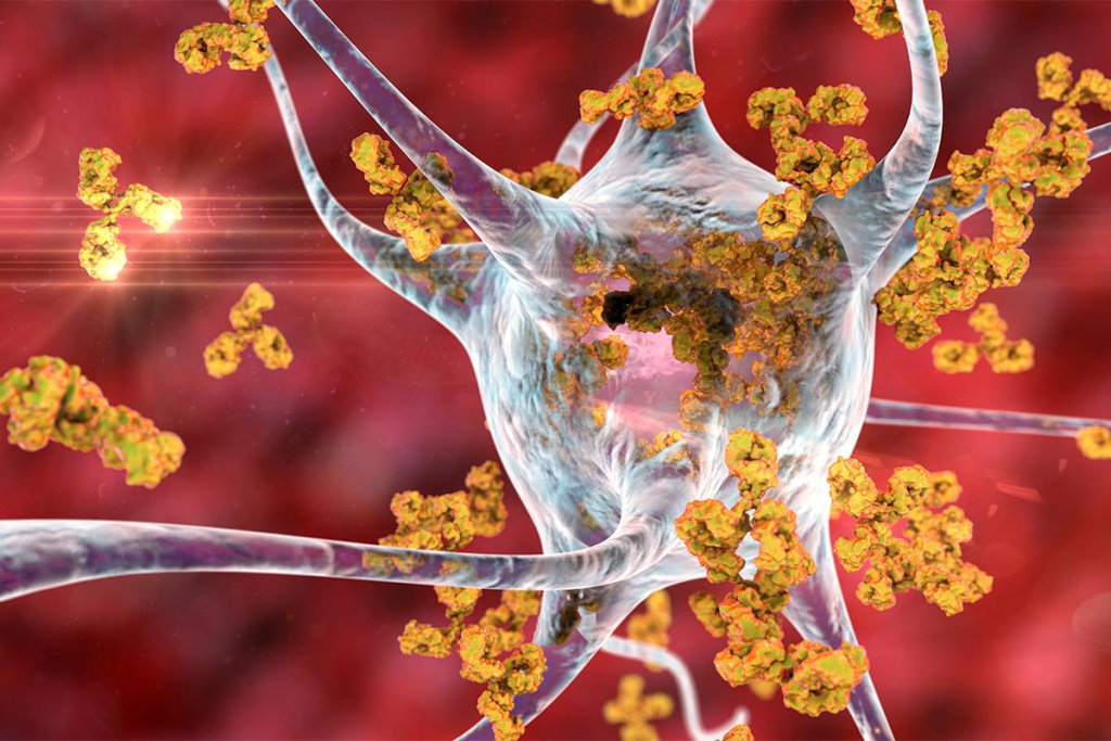 Life Expectancy with Autoimmune Hemolytic Anemia