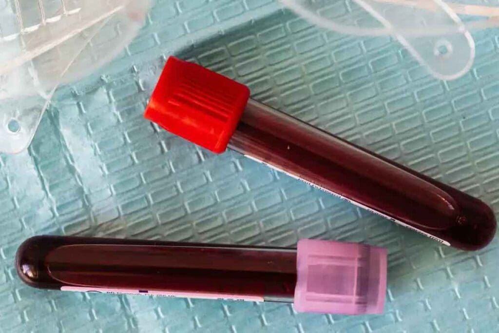 Is O Negative Blood Rare? Blood Types Ranked by Rarity (2025)