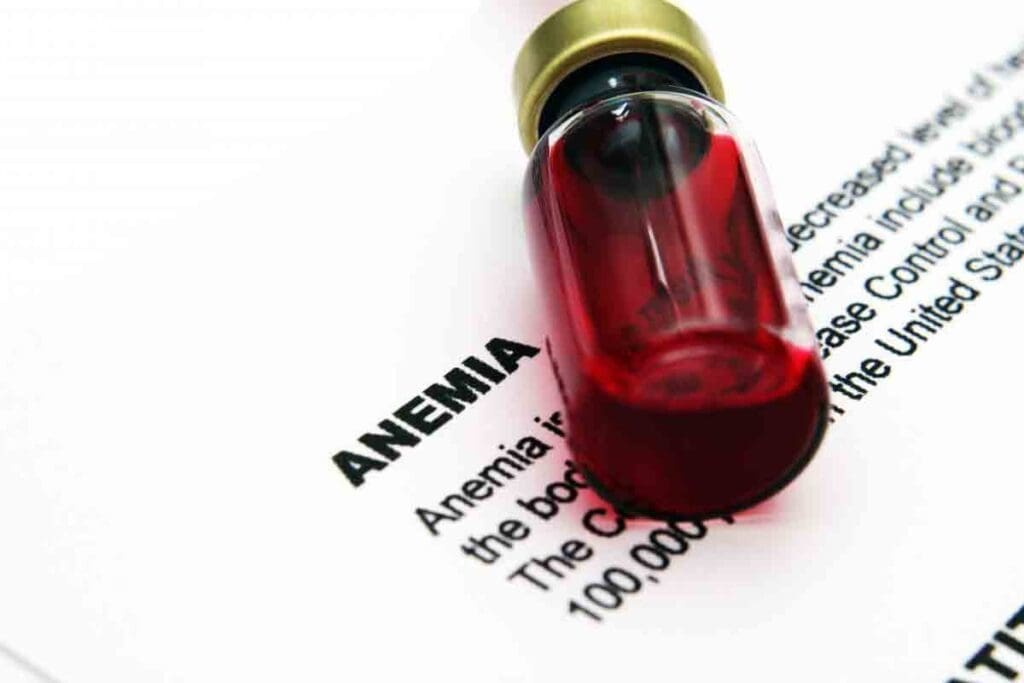 Can You Die of Anemia? Risks and Lifespan Facts