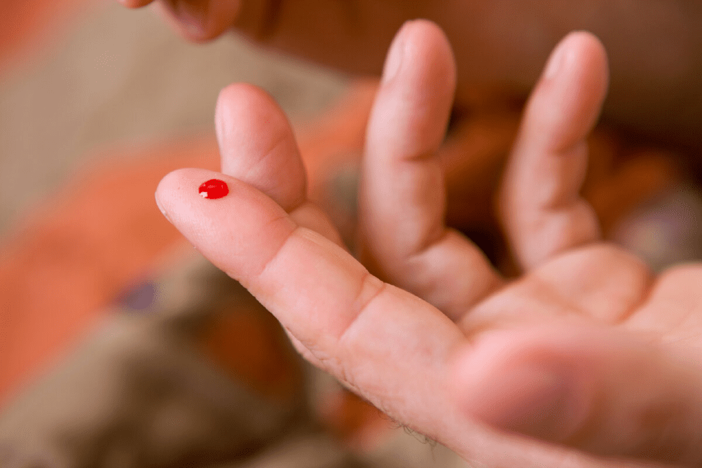 Hemophilia: Surprising Rare Clot Disorder