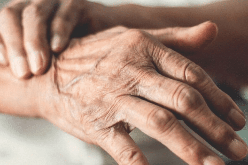 Progeria: A Critical and Devastating Disease