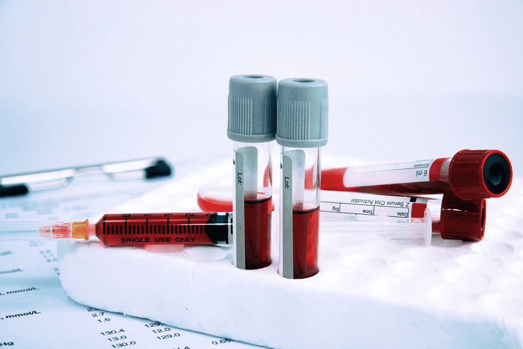 Blood Coagulation Test: The Ultimate Guide