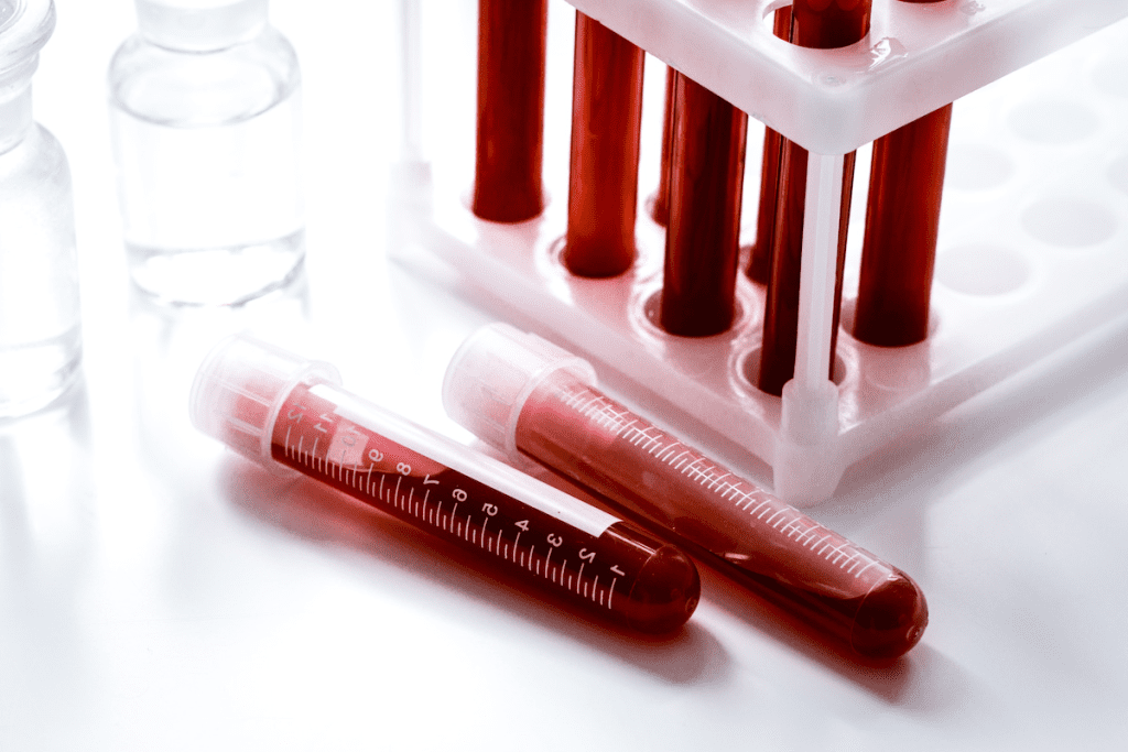 Mastocytosis: The Ultimate Guide to This Disease 1 Mastocytosis: The Ultimate Guide to This Disease