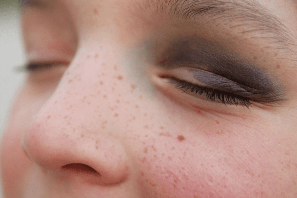 Blood Clotting Disorder: A Critical Overview