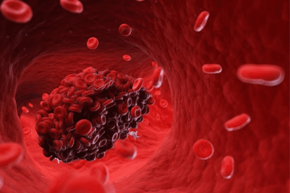 5 Definitive Warnings of Coagulation Disease of Blood