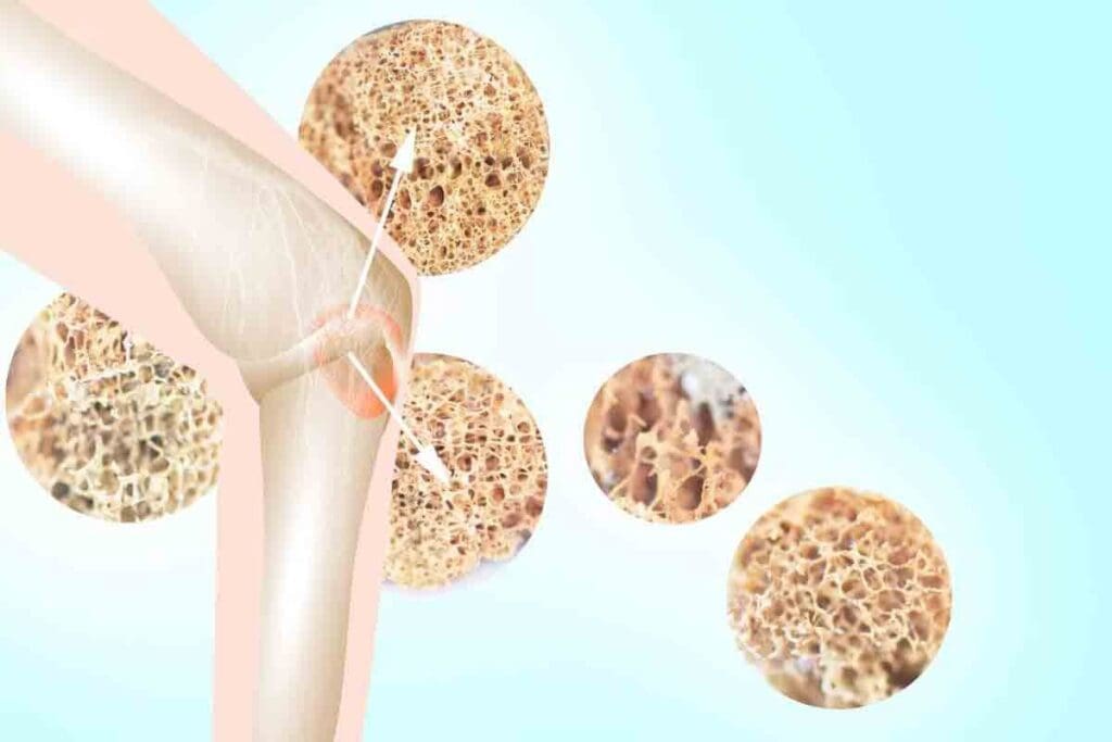 Bone Marrow Abnormality: Types and Key Causes