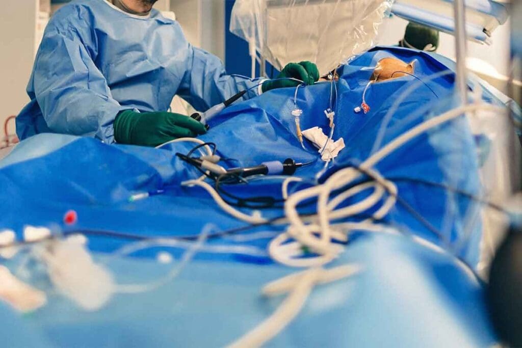 Is an Ablation Considered Surgery? Explained