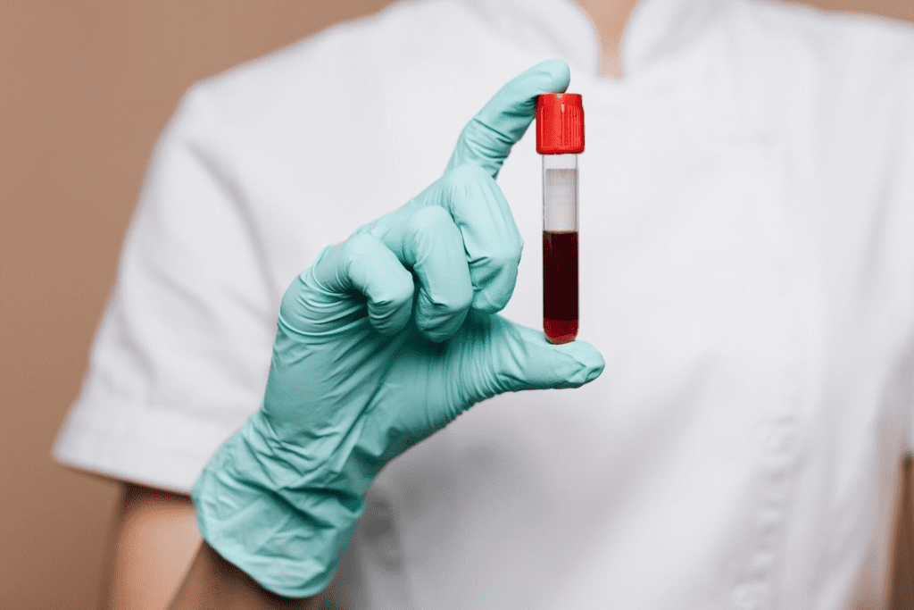 What Are the Most Common Blood Infections? Bacteremia Guide