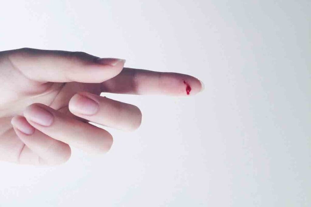 is the most common cause of bleeding disorders — 7 Key Facts